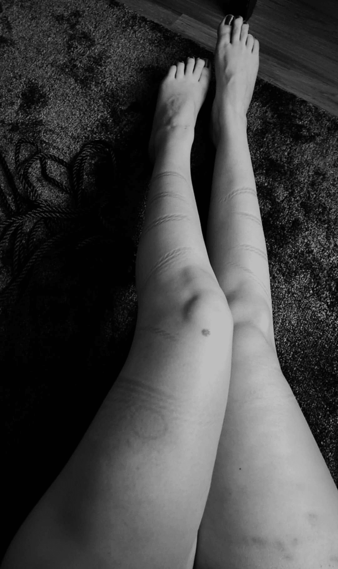 Nakne bein med tau-merker etter bondage