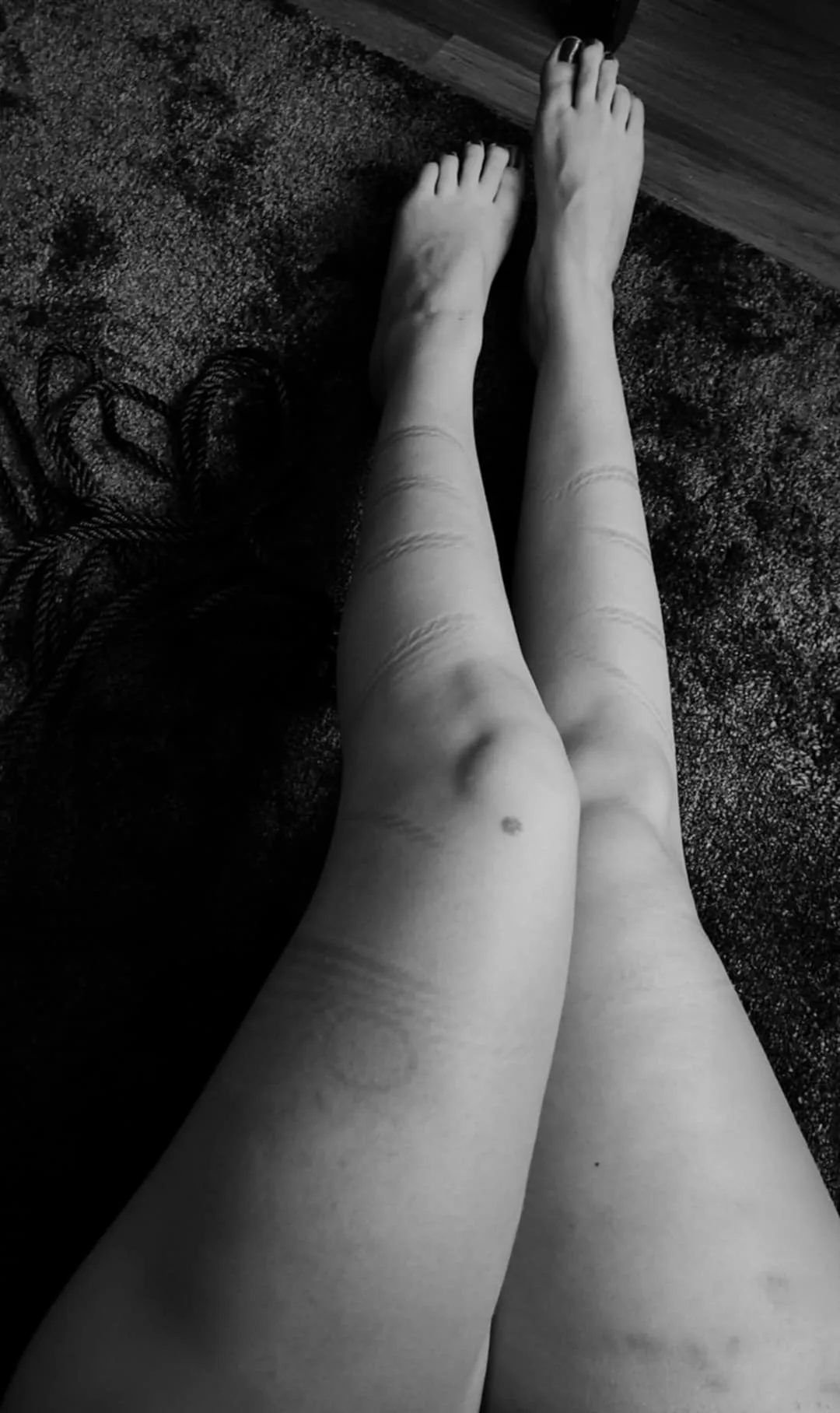 Nakne bein med tau-merker etter bondage
