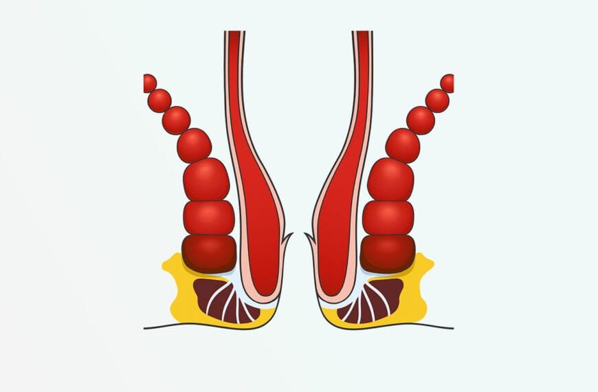 anal anatomi tegning
